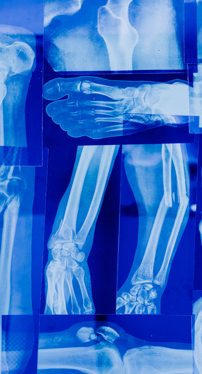 Dr Pravin Deokate Ortho Background